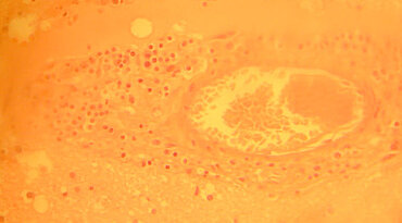 Toxoplasma gondii