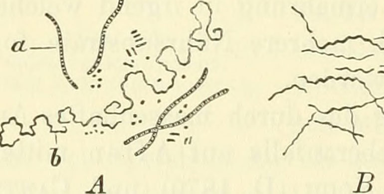 Leptospirose